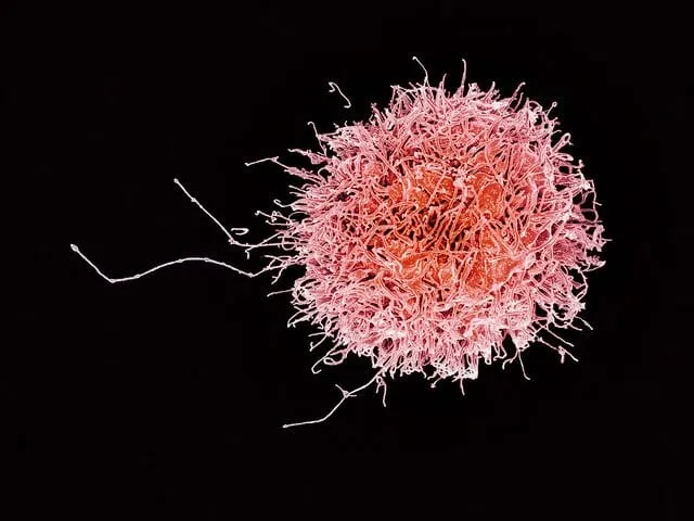 Nuove frontiere dell'immunoterapia: linfociti NK modificati per combattere i tumori