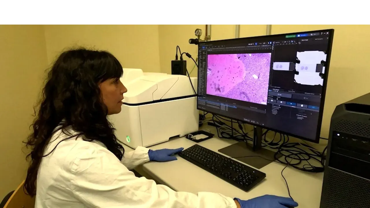 Tumori: la posizione delle cellule svela nuovi indizi sull’aggressività del cancro
