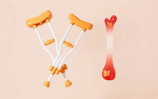 Ortopedia Digitale a Erba: Un Intervento Rivoluzionario Restituisce il Cammino a una Paziente di 48 Anni