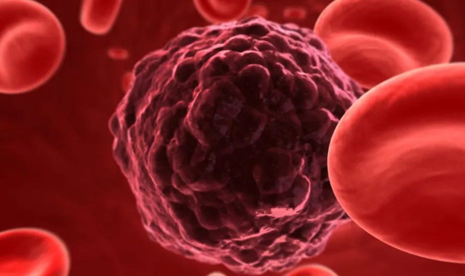 Rivoluzione italiana nella diagnosi precoce dei tumori: la luce come strumento per distinguere cellule sane e tumorali