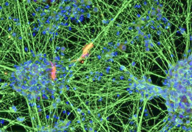 Dal sangue di un 80enne cellule staminali neurali giovanissime