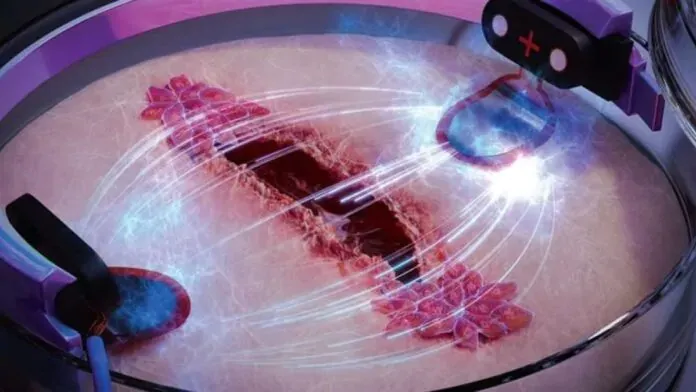 Cellule immunitarie riprogrammate: una svolta nella guarigione delle ferite grazie alla stimolazione elettrica dei macrofagi