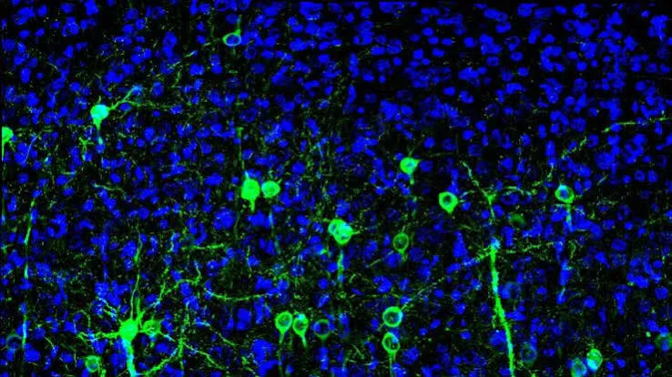 Il cervello lavora come un LLM: neuroni generalisti in 43 aree