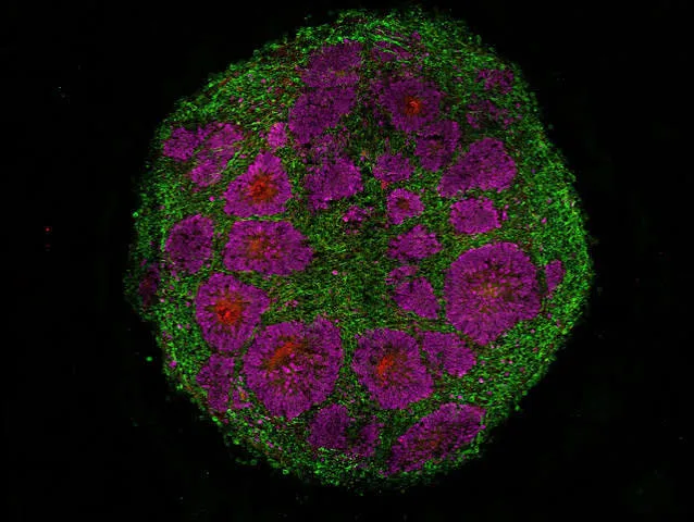 Il record di Harvard: organoidi cerebrali vivi oltre 5 anni in laboratorio