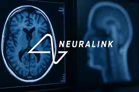 Neuralink: Lo stato avanzato della sperimentazione sugli impianti cerebrali umani nel 2025