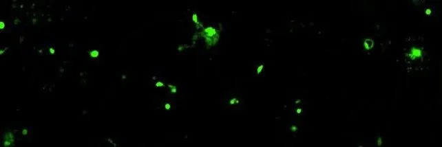 L'interruttore IIT prova a portare le CAR-T sui tumori solidi