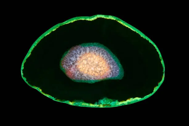 Metastasi, scoperta l'architettura segreta: è la stessa che guida la formazione dell'embrione