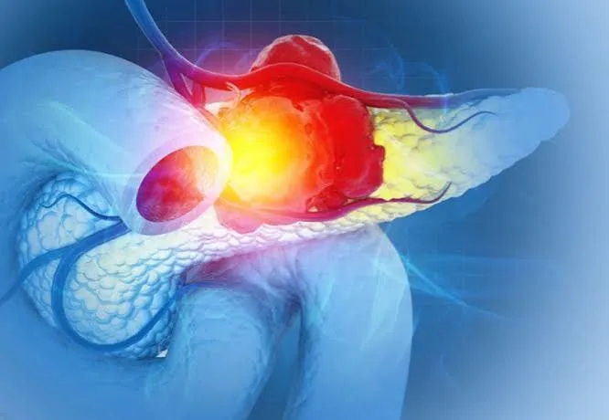 Pancreas: scoperto il gene Myc che riprogramma le cellule contro le cure