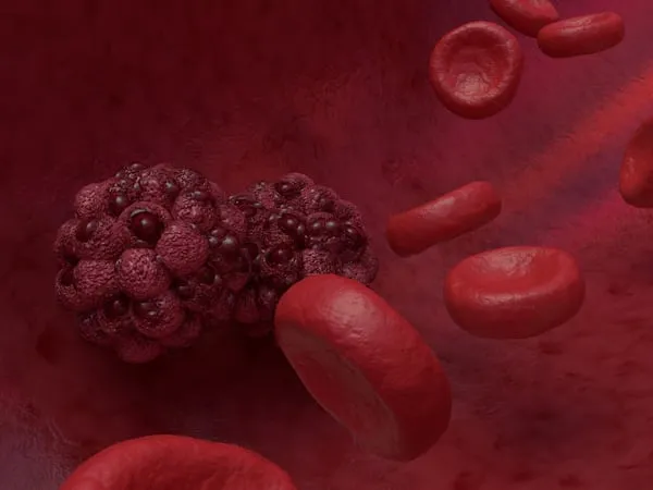 Terapia genica one-shot: una rivoluzione per il colesterolo LDL e i trigliceridi – Il successo della prima sperimentazione umana CTX310