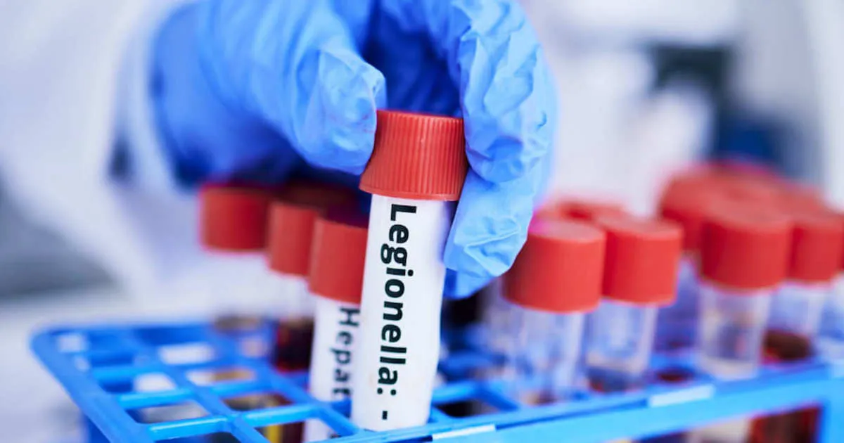 Come Gestire e Valutare il Rischio Legionella nel DVR delle Scuole: Guida Completa per Dirigenti e Referenti Scolastici