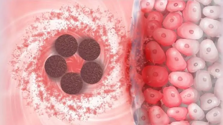 Uno sciame di microalghe consegna la chemio dentro il tumore alla vescica