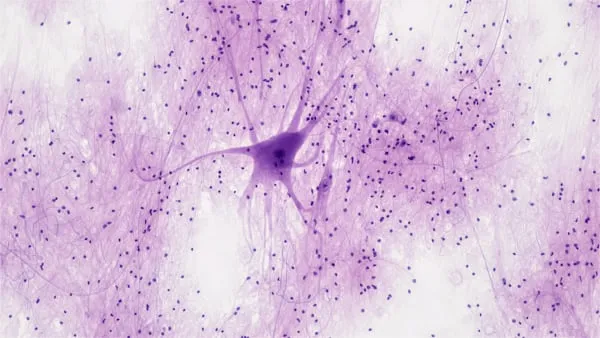 Uno studio del CIBIO di Trento svela il ruolo di MYC nella SLA