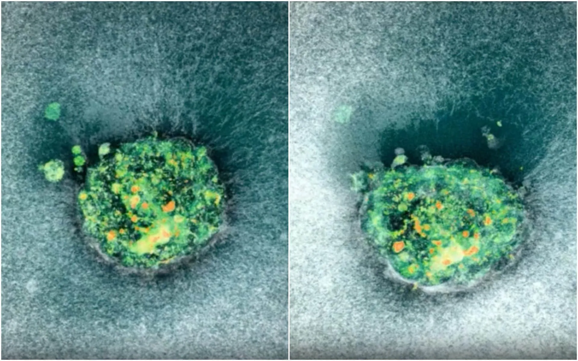 Ripreso Per la Prima Volta in 3D l’Impianto di un Embrione Umano: Una Svolta per la Scienza