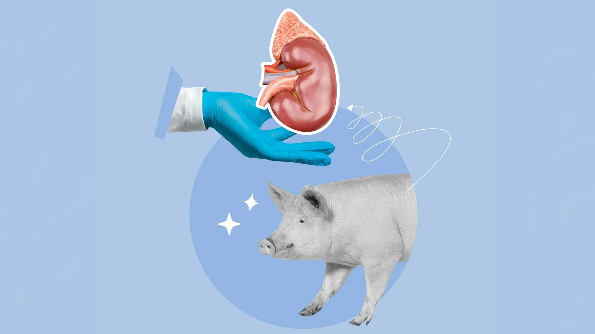 La Nuova Frontiera del Trapianto Renale: Via Libera dalla FDA al Primo Trial Clinico su Reni di Maiale Geneticamente Modificati